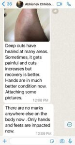 Testimonial