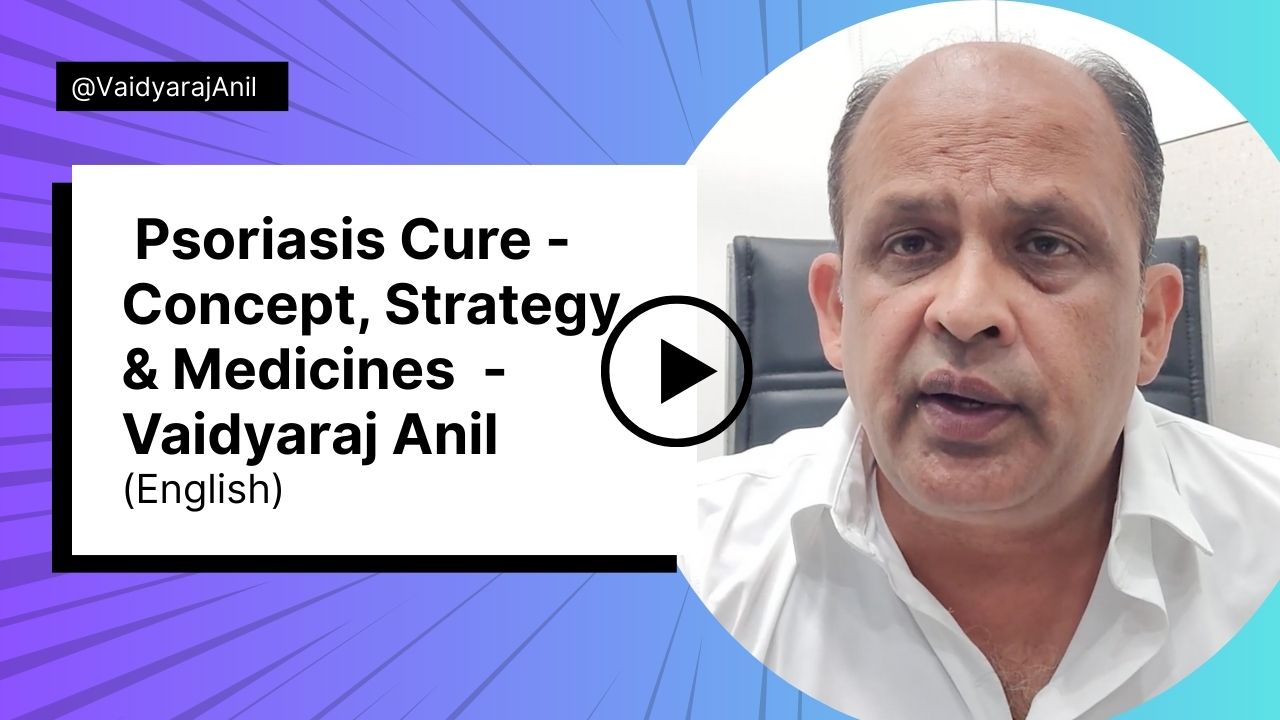 Psoriasis Cure - Concept, Strategy & Medicines - Vaidyaraj Anil (English)